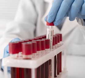 hse_0001_coronavirus-blood-samples-arrangement-lab
